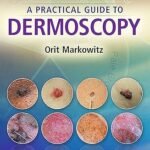 A Practical Guide to Dermoscopy (Color)