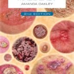 Dermatology Made Easy (Color)