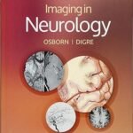 Imaging in Neurology (Color)
