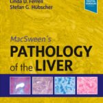 MacSween's Pathology of the Liver Volume 1-2 (Color)