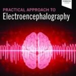 Practical Approach to Electroencephalography (Color)