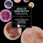 Atlas of Dermoscopy (Color)