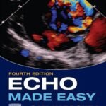 Echo Made Easy (Color)