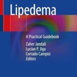 Lipedema: A Practical Guidebook (Color)