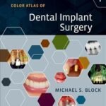 Color Atlas of Dental Implant Surgery (Color)