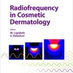 Radiofrequency in Cosmetic Dermatology (Color)