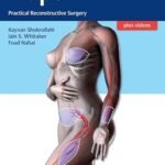 Flaps: Practical Reconstructive Surgery (Color)