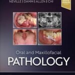 Oral and Maxillofacial Pathology Volume 1-2 (Color)