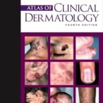Atlas of Clinical Dermatology (Color)