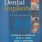 Dental Implants: The Art and Science (Color)