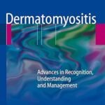 Dermatomyositis: Advances in Recognition, Understanding and Management (Color)