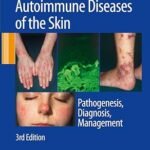 Autoimmune Diseases of the Skin: Pathogenesis, Diagnosis, Management (Color)