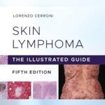 Skin Lymphoma: The Illustrated Guide (Color)