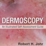 Dermoscopy: An Illustrated Self-Assessment Guide (Color)