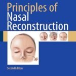 Principles of Nasal Reconstruction (Color)
