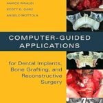 Computer-Guided Applications for Dental Implants, Bone Grafting, and Reconstructive Surgery (Color)