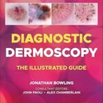 Diagnostic Dermoscopy: The Illustrated Guide (Color)