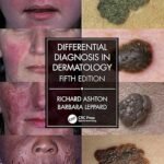 Differential Diagnosis in Dermatology (Color)
