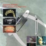 Clinical Problem Solving in Prosthodontics (Color)