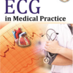 ECG in Medical Practice (Color)
