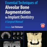 Essential Techniques of Alveolar Bone Augmentation in Implant Dentistry (Color)