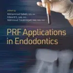 PRF Applications in Endodontics (Color)