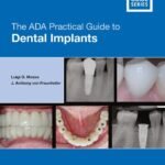 The ADA Practical Guide to Dental Implants (Color)