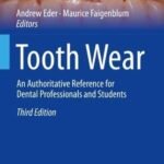Tooth Wear (Color)