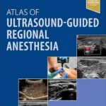 Atlas of Ultrasound-Guided Regional Anesthesia (Color)