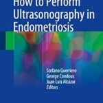 How to Perform Ultrasonography in Endometriosis (Color)