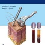 PRP and Microneedling in Aesthetic Medicine (Color)