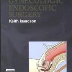Complications of Gynecologic Endoscopic Surgery (Color)
