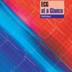 ECG at a Glance (Color)