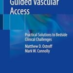 Ultrasound Guided Vascular Access: Practical Solutions to Bedside Clinical Challenges (Color)