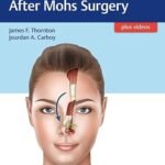 Facial Reconstruction After Mohs Surgery (Color)
