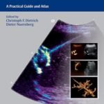 Interventional Ultrasound: A Practical Guide and Atlas (Color)