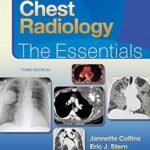 Chest Radiology: The Essentials (Color)