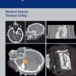 CT of The Head and Spine (Color)