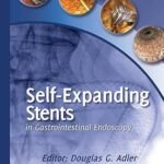 Self-Expanding Stents in Gastrointestinal Endoscopy (Color)
