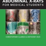 Abdominal X-rays for Medical Students (Color)