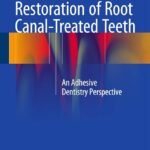 Restoration of Root Canal-Treated Teeth (Color)