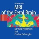 MRI of the Fetal Brain (Color)