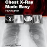 Chest X-Ray Made Easy (Color)