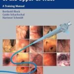 Endoscopy of the Upper GI Tract: A Training Manual (Color)