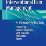 Ultrasound for Interventional Pain Management: An Illustrated Procedural Guide (Color)