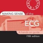 Making Sense of the ECG A Hands-on Guide (Color)