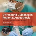 Ultrasound Guidance in Regional Anaesthesia: Principles and practical implementation (Color)