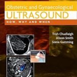 Obstetric & Gynaecological Ultrasound: How, Why and When (Color)