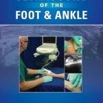 Ultrasound of the Foot and Ankle: Diagnostic and Interventional Applications (Color)