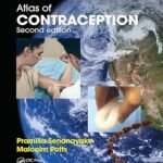 Atlas of Contraception (Color)